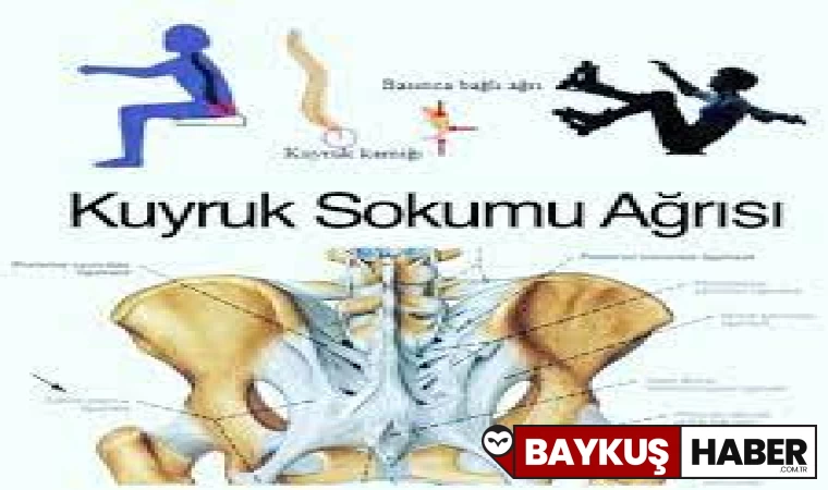 Kuyruk Sokumu İncinmesine İyi Gelen Yöntemler ve Tedaviler