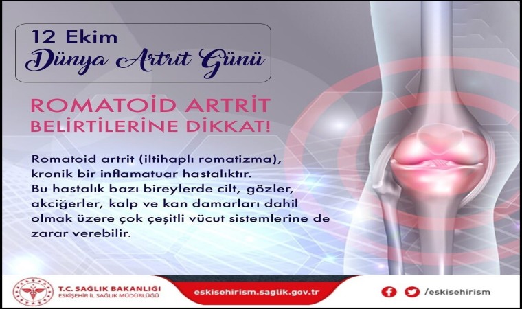 Bilgeden Dünya Artrit Günü açıklaması