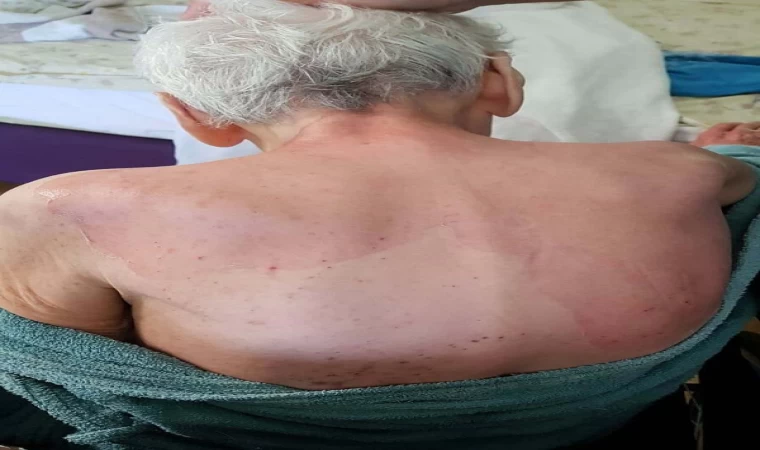 Huzurevindeki ölümde beklenen rapor geldi: Dermatolojik hastalık tespit edilmedi