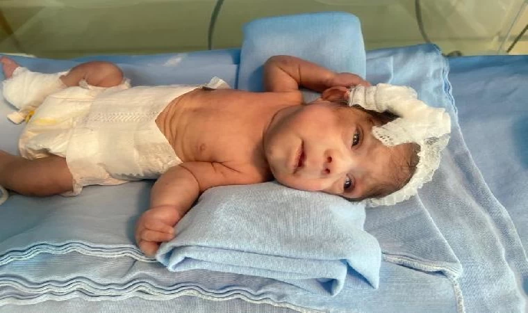 515 gram doğan Elif bebek, 98 günlük tedavi sonrası hayata tutundu / Ek fotoğraf