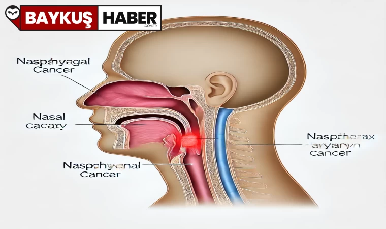 Nazofarenks Kanseri: Belirtiler, Tanı ve Tedavi Yöntemleri