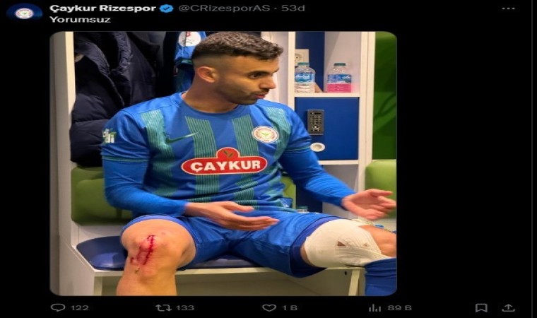 Çaykur Rizespor, Rachid Ghezzalın darbe alan ayağının fotoğrafını paylaştı