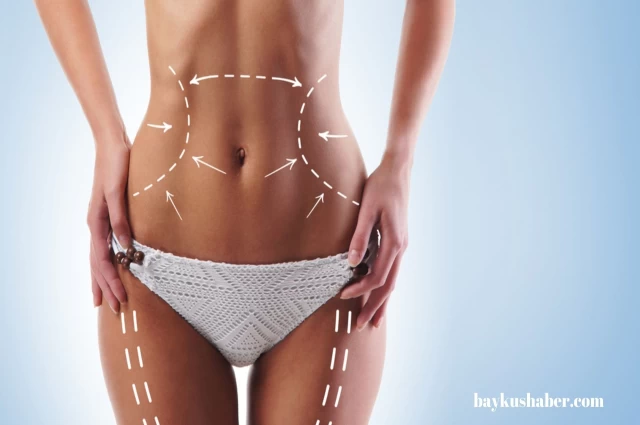 Liposuction nedir, nasıl yapılır? Liposuction zayıflatıyor mu, işe yarıyor mu?