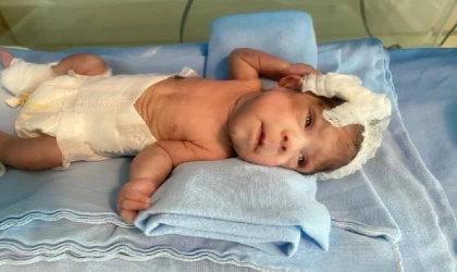 515 gram doğan Elif bebek, 98 günlük tedavi sonrası hayata tutundu / Ek fotoğraf